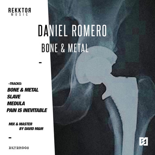 Daniel Romero-Bone and Metal