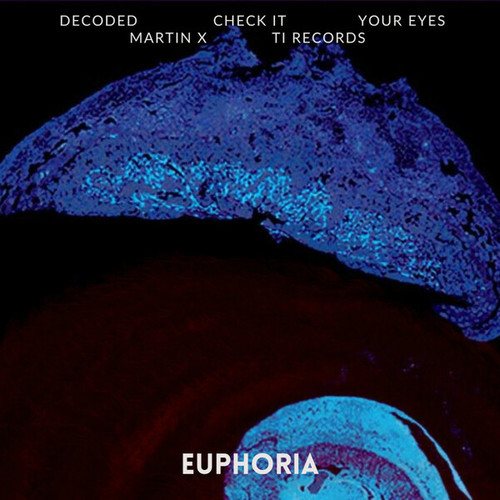 Martin X-Euphoria