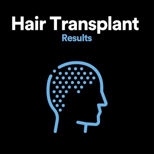 Hair Transplant Results