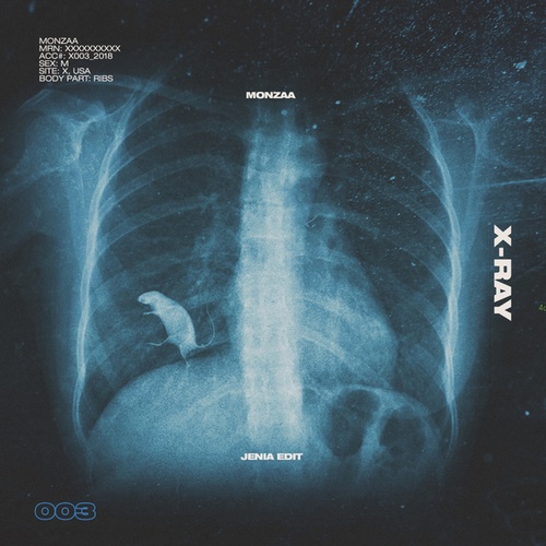 Monzaa-X-Ray